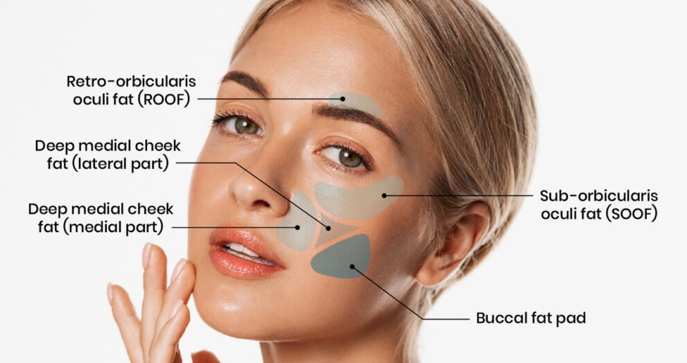 what is buccal fat
