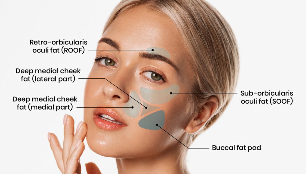 what is buccal fat