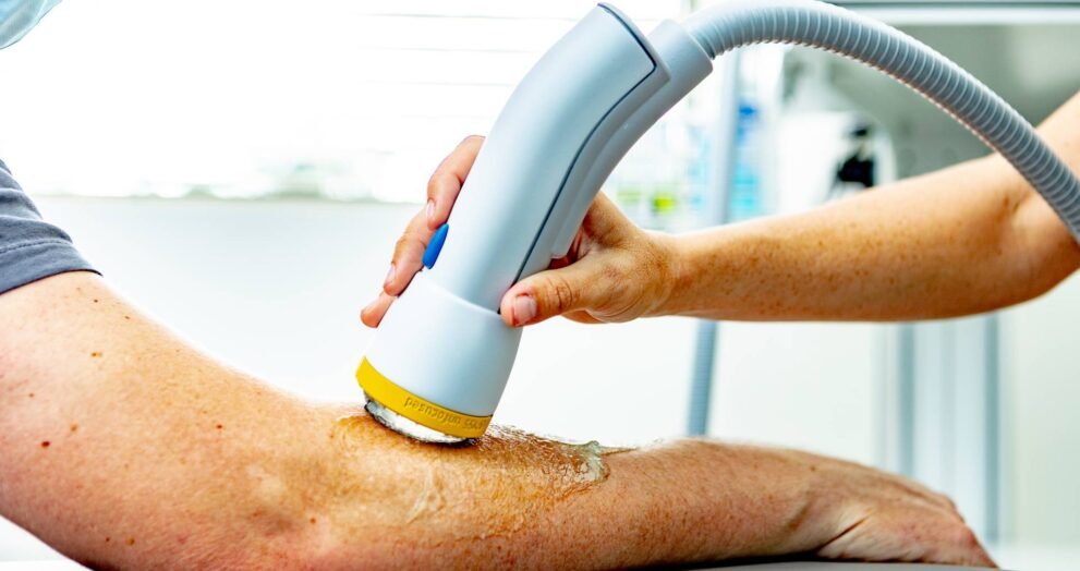 softwave therapy