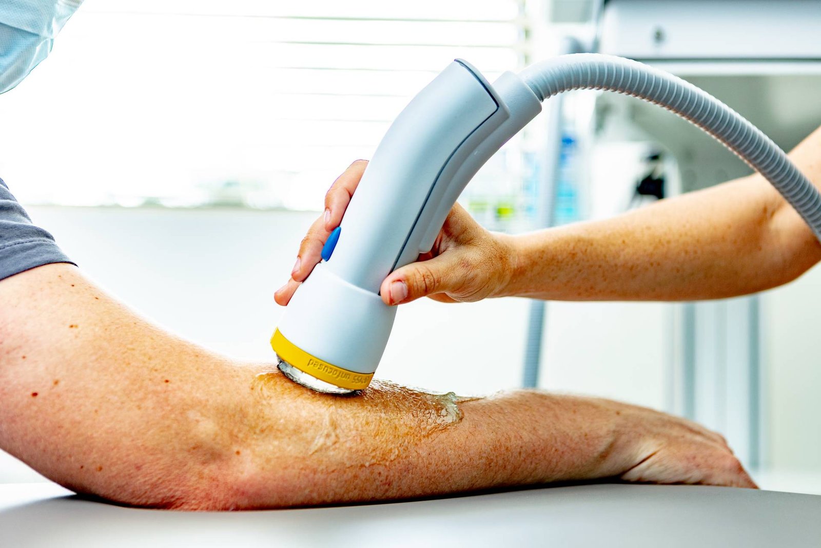softwave therapy
