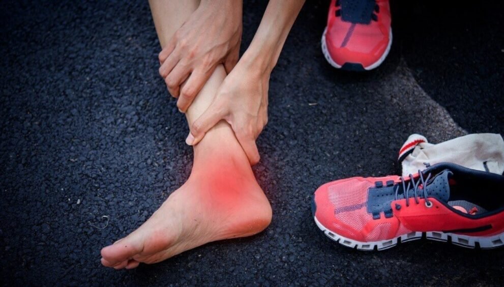 ankle sprain or fracture