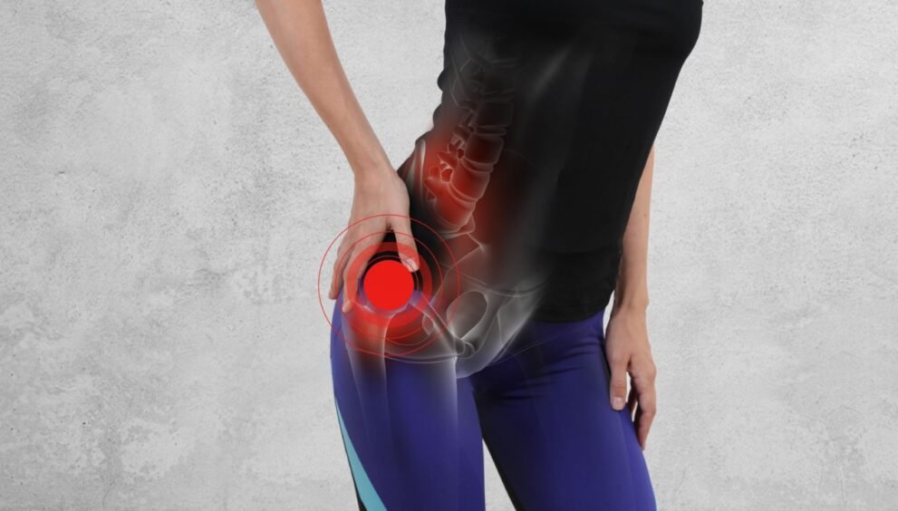hip stretches for trochanteric bursitis