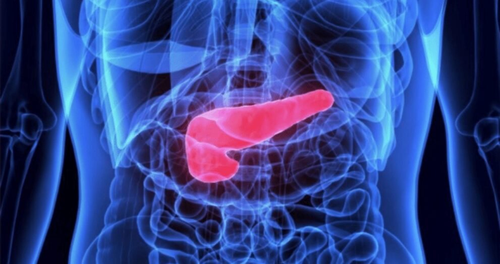 Fatty Pancreas