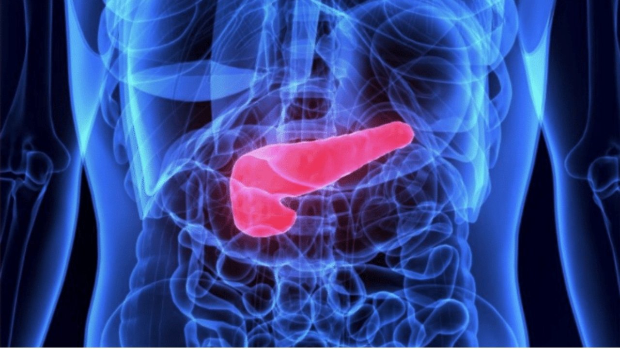 Fatty Pancreas
