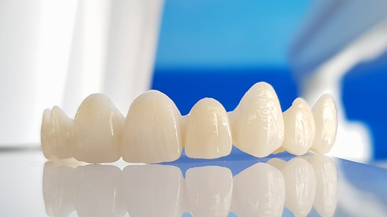 zirconia crown