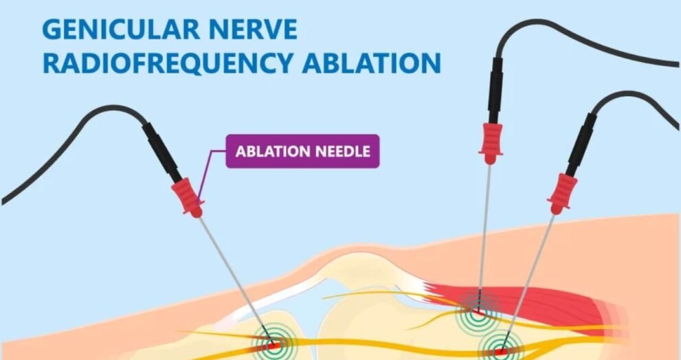 how long will a nerve block last