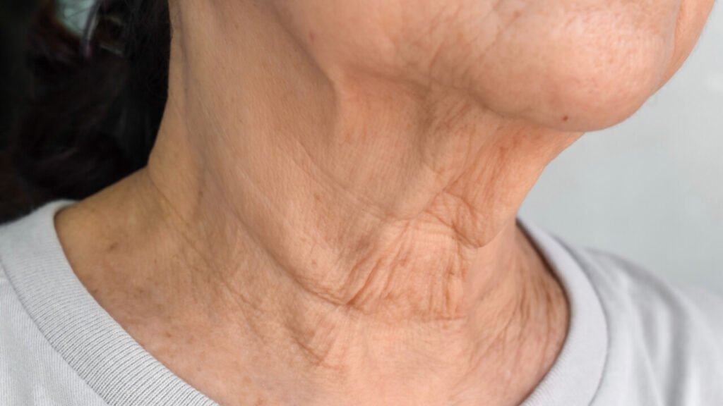 how to get rid of neck wrinkles