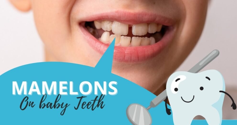Mamelon teeth