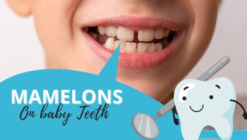 Mamelon teeth