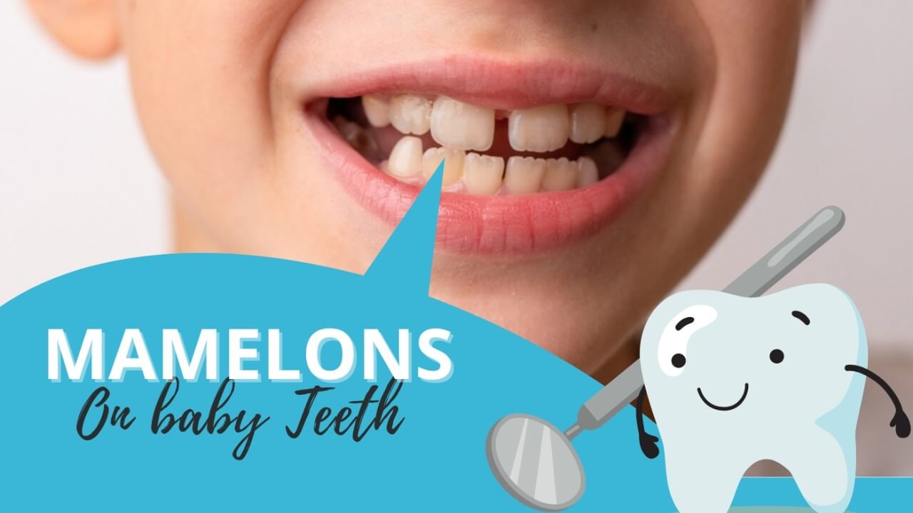 Mamelon teeth